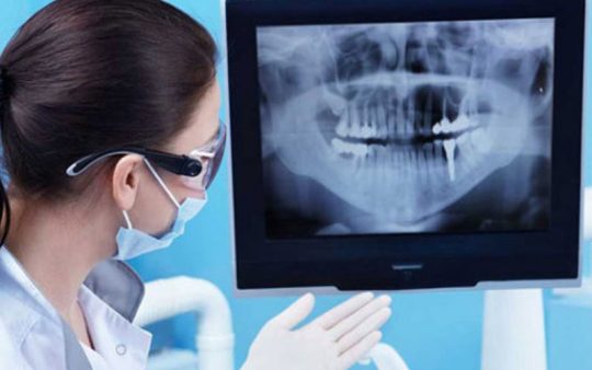 Bạn sẽ được chụp X-quang răng trước khi tiến hành nhổ