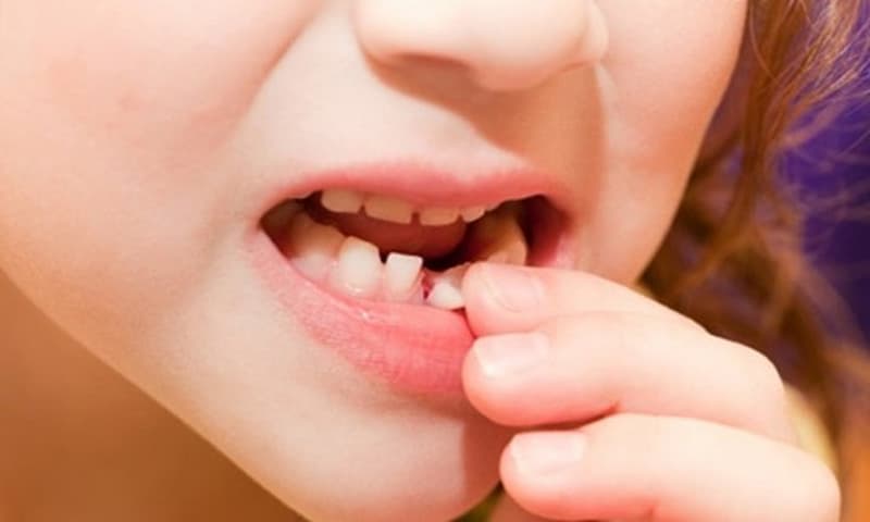 Nhổ răng sữa còn sót chân răng có nguy hiểm không là thắc mắc của rất nhiều phụ huynh