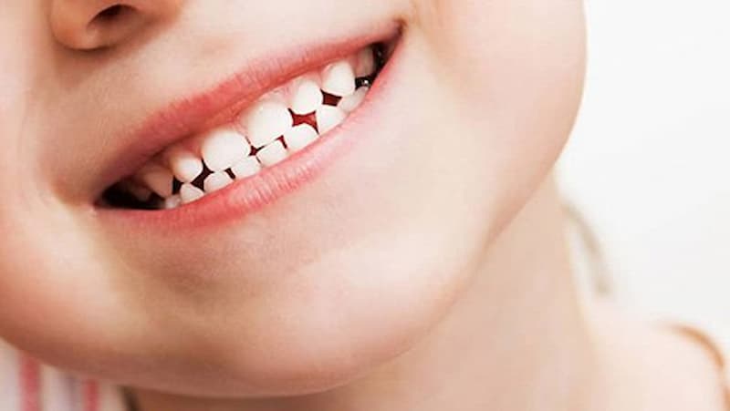 Để hạn chế tình trạng nhổ răng sữa còn sót chân răng, nhiều người chọn đưa bé đến các địa chỉ nha khoa uy tín