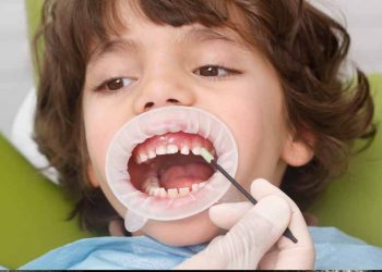 Tùy tình trạng sâu răng ở trẻ bác sĩ sẽ có chỉ định nha khoa phù hợp