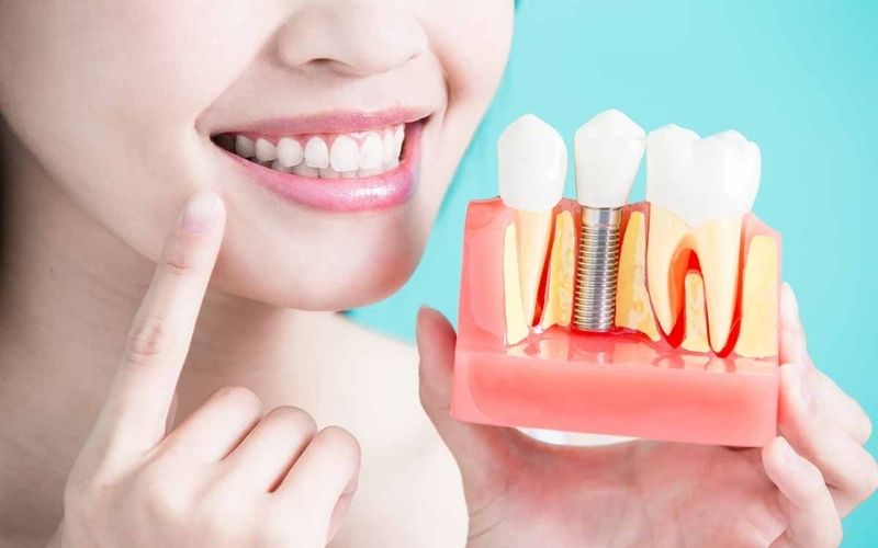 Đối tượng nên sử dụng phương pháp là người bị mất răng, làm ảnh hưởng tới khả năng ăn nhai trên khuôn hàm