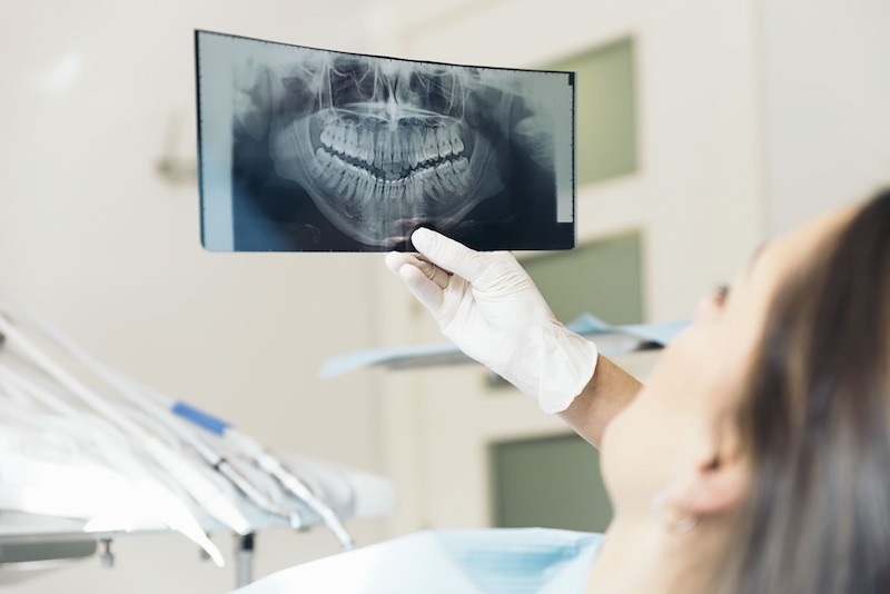 Thăm khám trước khi trồng răng giúp loại bỏ tối đa biến chứng có thể gặp phải sau khi cấy Implant