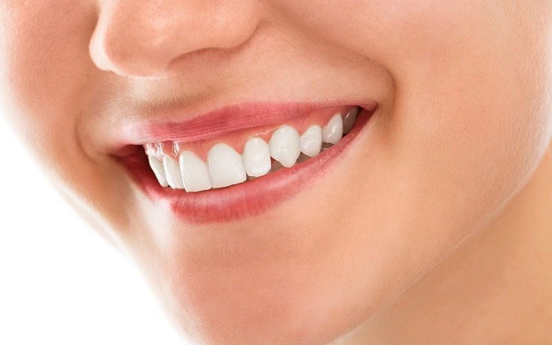 Giá thành cho mỗi chiếc răng toàn sứ thường sẽ đắt hơn so với răng sứ kim loại