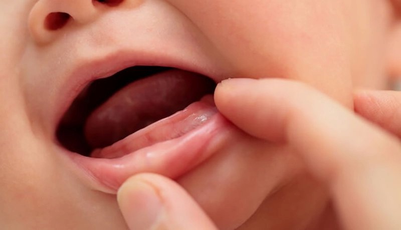 Nhiều trường hợp trẻ mọc răng chậm hơn so với quy trình chung