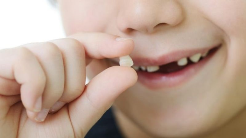 Chỉ nhổ răng sữa mọc lệch cho trẻ nếu răng đã lung lay theo quy luật tự nhiên