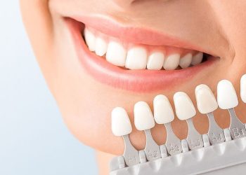 Keo Dán Răng Sứ Có Những Loại Nào? Nên Mua Ở Đâu Uy Tín?