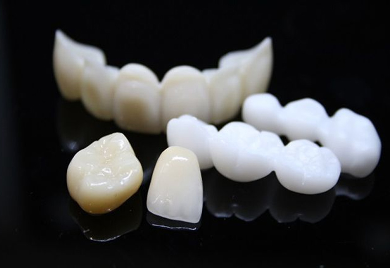 Bọc răng sâu bao nhiêu tiền sẽ phụ thuộc vào loại răng sứ mà bạn lựa chọn