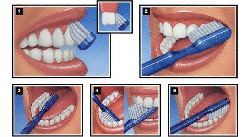 Đánh răng đúng cách giúp chăm sóc răng miệng tốt nhất