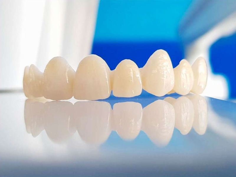 Mão sứ là một dạng răng giả dùng trong nha khoa thẩm mỹ