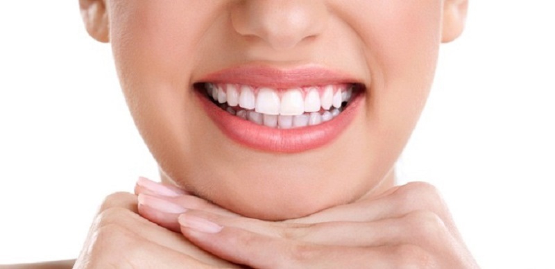 Bọc răng sứ cho răng hô giúp cải thiện tình trạng thẩm mỹ nhanh chóng