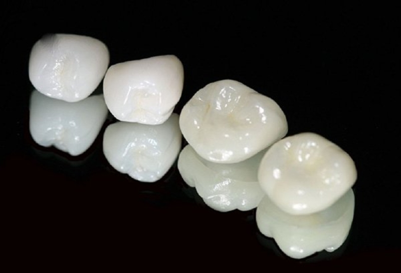 Răng sứ Diamond phù hợp sử dụng để phục hình thẩm mỹ