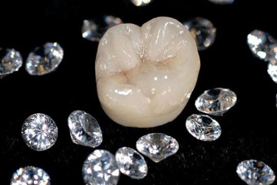 Răng sứ kim cương