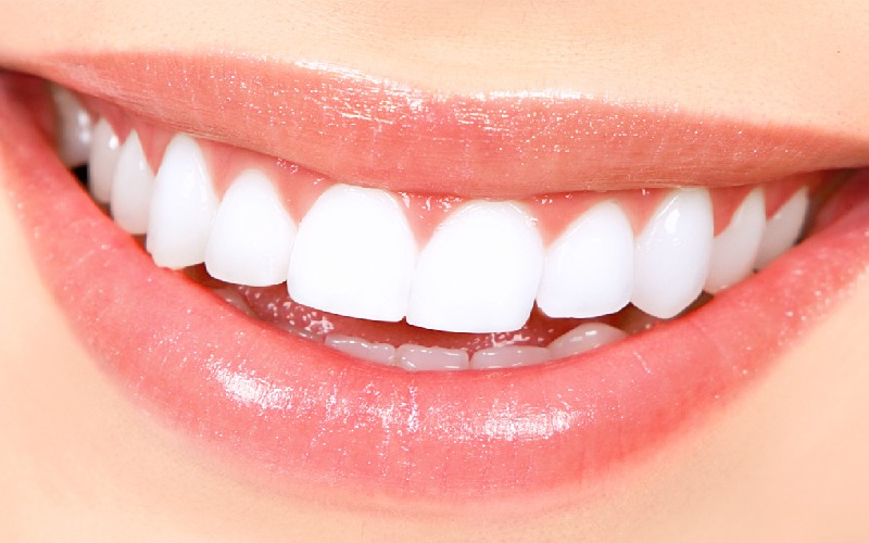 Răng sứ Zirconia có tính thẩm mỹ cao, tự nhiên như răng thật