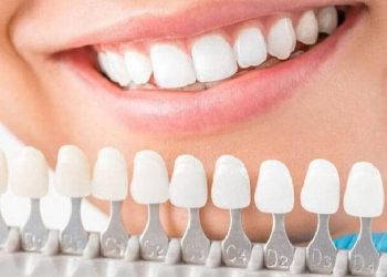 Răng Sứ Zirconia Có Mấy Loại? Ưu Điểm Và Giá Bọc Răng