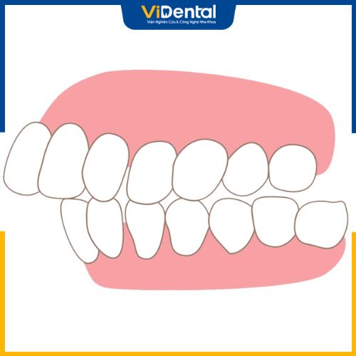Bạn đi khám để biết được tình trạng răng của mình