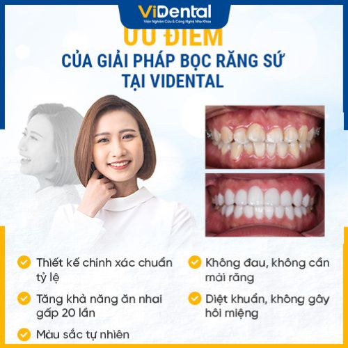 Bọc răng sứ tại đây có nhiều ưu điểm