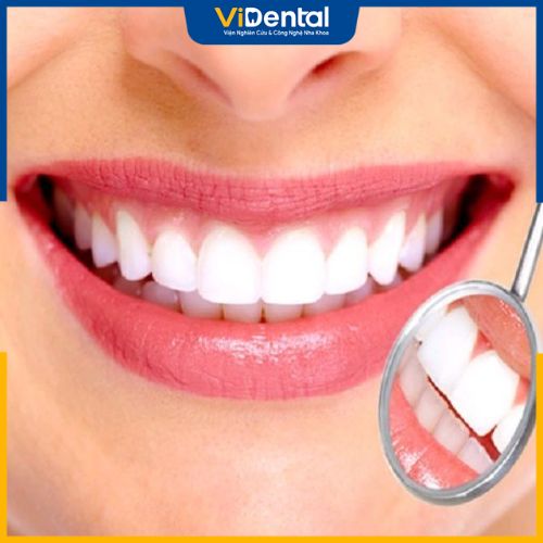 Bọc sứ cho răng là phương pháp có tính thẩm mỹ cao