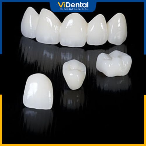 Lựa chọn sản phẩm răng sứ chất lượng để đảm bảo độ bền sau bọc sứ