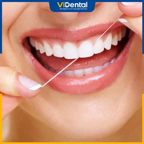 Lưu ý cách chăm sóc răng miệng sau khi niềng răng