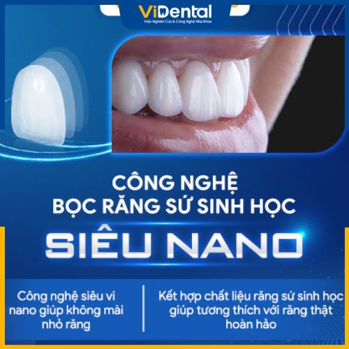 Ứng dụng công nghệ bọc răng sứ mới nhất - NANO BIOTECH 