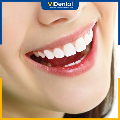 Lưu ý khi lựa chọn nha khoa tẩy trắng răng tại TPHCM