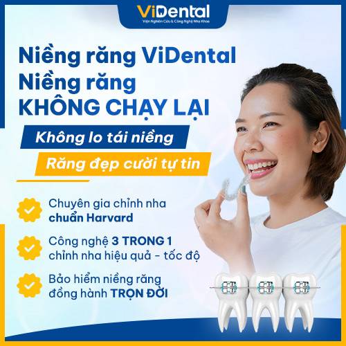 Vidental địa chỉ uy tín niềng răng trả góp tại Hà Nội 