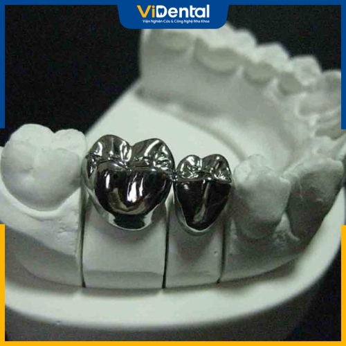 Răng bọc bạc có ưu điểm về độ bền cũng như khả năng chịu lực tốt 