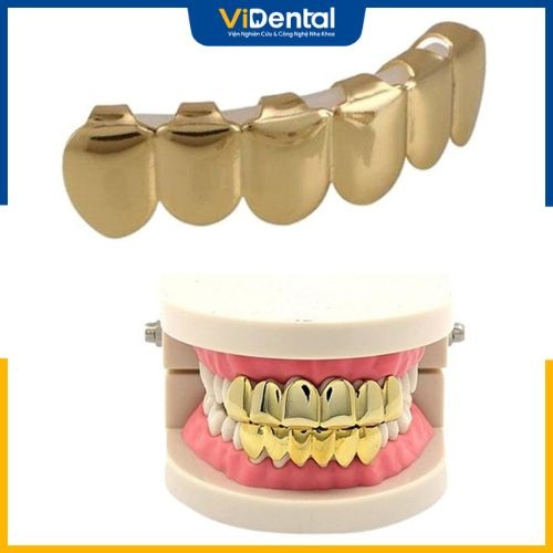 Mức giá cho mỗi chiếc răng bọc vàng khá cao, phù hợp cho những đối tượng có điều kiện kinh tế tốt