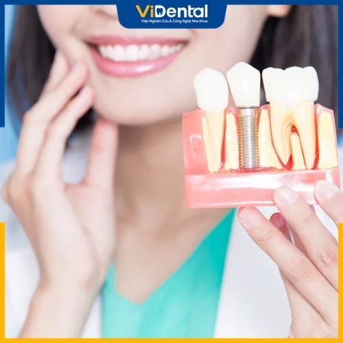 Trồng răng Implant sai kỹ thuật có thể gây ra biến chứng xấu cho răng miệng