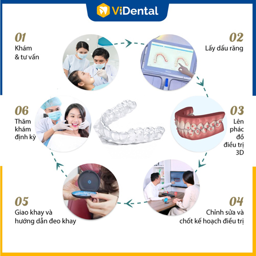 Quy trình niềng răng trong suốt cần đảm bảo đúng tiêu chuẩn
