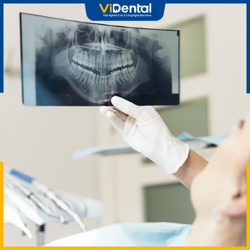 Trước khi niềng răng, bệnh nhân cần khám tổng quá toàn hàm