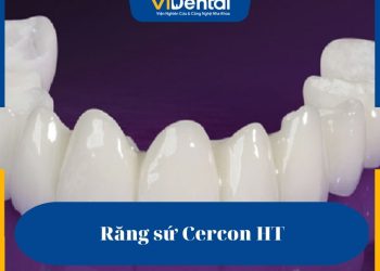 Răng sứ Cercon HT được ứng dụng và sản xuất trên dây chuyền công nghệ hiện đại, do đó đảm bảo về mặt chất lượng và tính thẩm mỹ cao