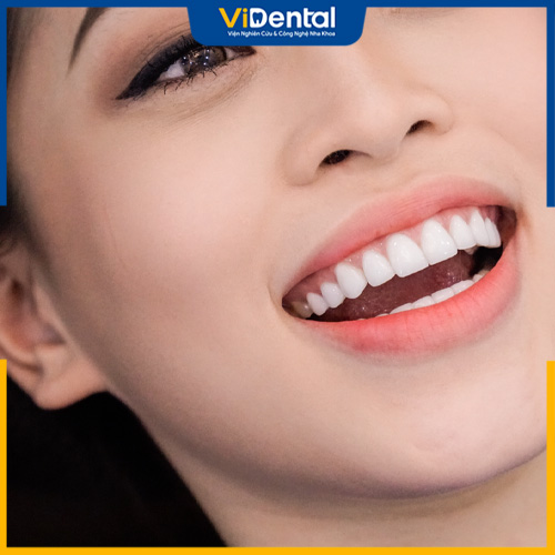 Răng HT Smile có thể duy trì được độ bền lâu dài