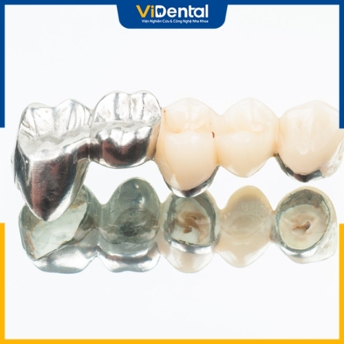 Răng sứ được sử dụng trong điều trị phục hình răng gãy rụng hoặc bị hư hỏng