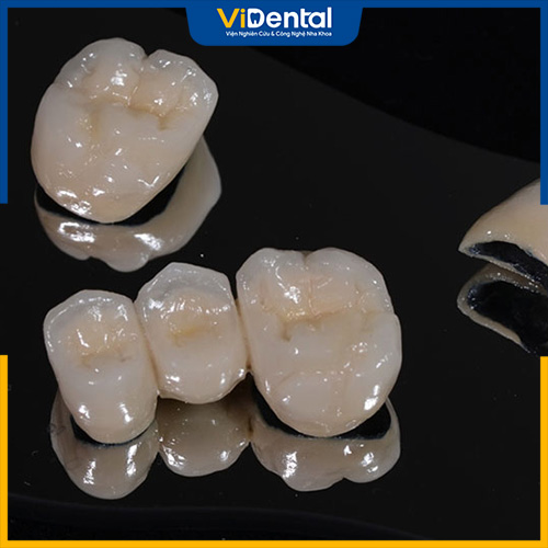 Răng sứ Mỹ có chất lượng và tính thẩm mỹ tương xứng với răng thật 