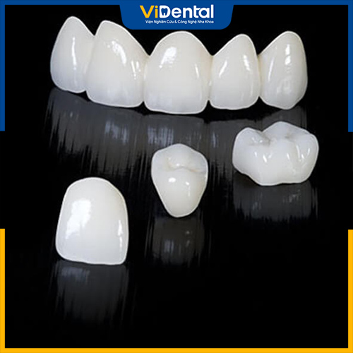 Răng lõi sứ kim loại có chất lượng và mức chi phí hợp lý