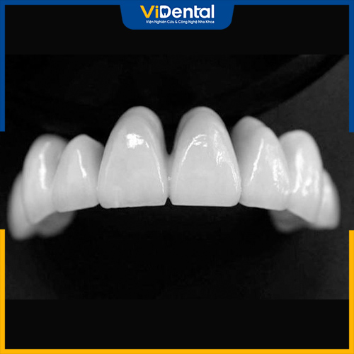 Răng sứ Nacera là thành quả nghiên cứ thành công từ thương hiệu sản xuất vật liệu nha khoa hàng đầu của Đức
