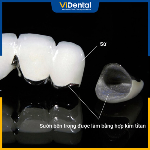 Răng sứ lõi Titan Vita được nghiên cứu và phân phối bởi công ty Vita ở Đức