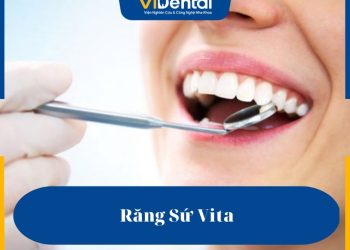 Răng sứ Vita có nhiều ưu điểm vượt trội về độ bền, khả năng chịu lực tốt và tính thẩm mỹ cao
