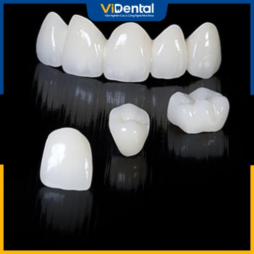 Răng toàn sứ được cấu tạo hoàn toàn từ sứ nguyên khối