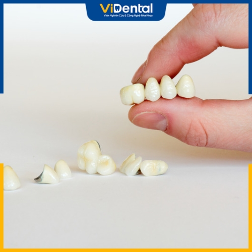 So sánh răng sứ Zirconia và Cercon về các mặt tương đồng