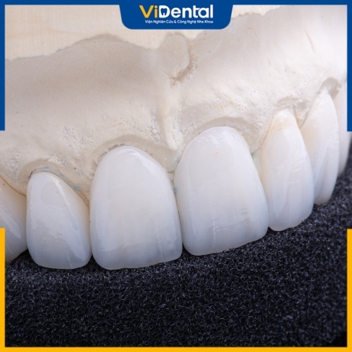 Răng sứ Zirconia được đánh giá cao về chất lượng và hiệu quả điều trị