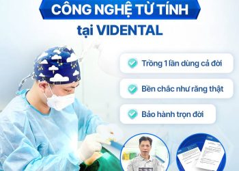 Địa Chỉ Trồng Răng Implant Tại Hà Nội Uy Tín