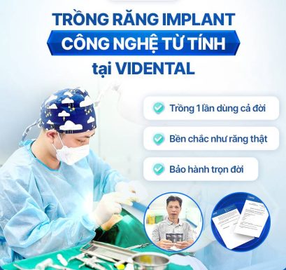 Địa Chỉ Trồng Răng Implant Tại Hà Nội Uy Tín