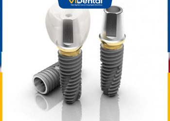 Trụ Implant Dentium Mỹ được nhiều khách hàng tin tưởng lựa chọn trong kỹ thuật cấy ghép Implant