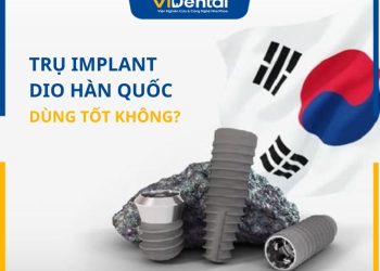 Trụ Implant DIO Hàn Quốc Có Tốt Không