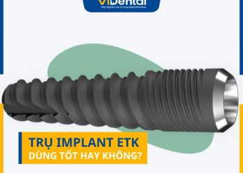 Trụ Implant ETK Dùng Có Tốt Không