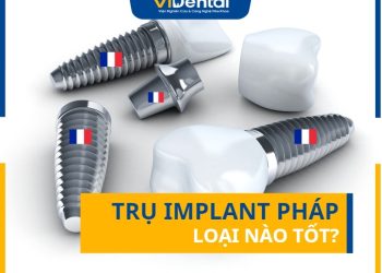 Trụ Implant Pháp Loại Nào Tốt