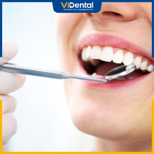 Phương pháp bọc sứ khắc phục hiệu quả răng bị gãy 