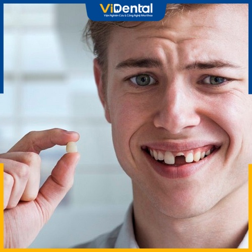 Răng bị gãy làm mất tính thẩm mỹ khuôn mặt 
